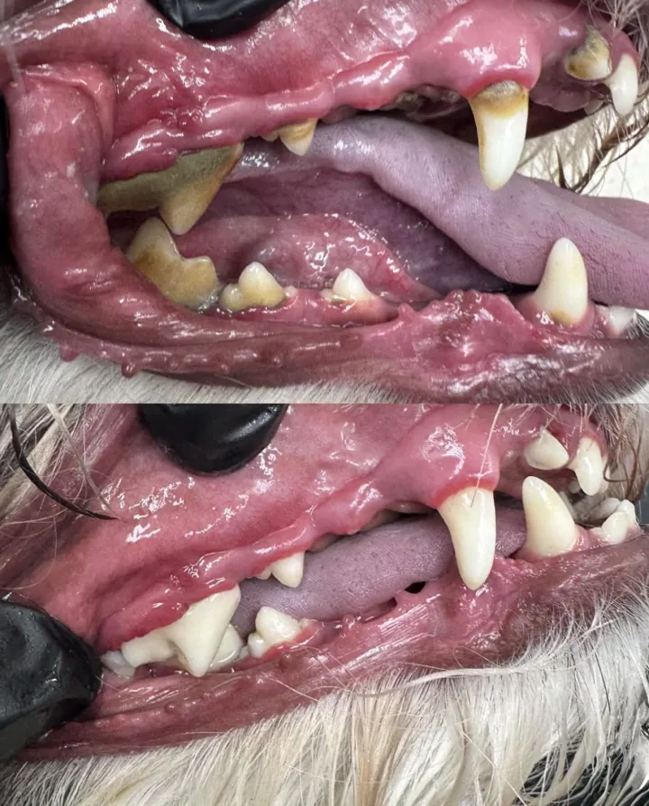 Calm Bite Before and After 9